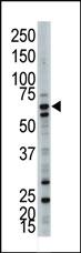 Anti-UBQLN3 Rabbit Polyclonal Antibody