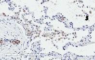 Anti-TREM2 Antibody (2 µg/ml) staining of paraffin embedded Human Lung. Microwaved antigen retrieval with citrate buffer pH 6, HRP-staining