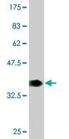 Anti-FMR1 Mouse Monoclonal Antibody [clone: 3E11]