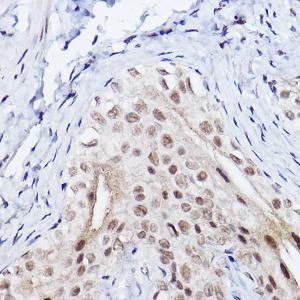 Immunohistochemistry analysis of paraffin-embedded rat bladder using Anti-SerpinB3 / SCCA Antibody [ARC2508] (A308934) at a dilution of 1:100 (40x lens)