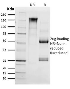 SDS-PAGE analysis of Anti-CD68 Antibody [C68/2511] under non-reduced and reduced conditions; showing intact IgG and intact heavy and light chains, respectively. SDS-PAGE analysis confirms the integrity and purity of the antibody.