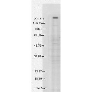 Anti-TRPM7 Mouse Monoclonal Antibody [clone: S74]