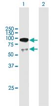 Anti-UTP3 Mouse Polyclonal Antibody