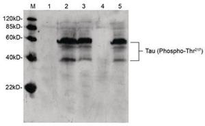 Anti-MAPT Rabbit Polyclonal Antibody