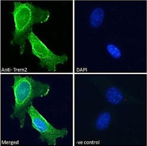 Anti-TREM2 Antibody (A84374) - Immunofluorescence analysis of paraformaldehyde fixed 3T3-L1 cells, permeabilized with 0.15% Triton. Primary incubation 1hr (10 µg/ml) followed by Alexa Fluor 488 secondary antibody (2 µg/ml), showing membrane staining