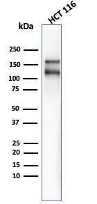 Western blot analysis of HCT116 cell lysate using Anti-MSH6 Antibody [MSH6/4592R]