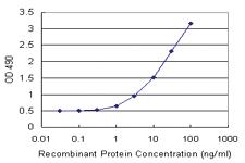 Anti-PRKCSH Polyclonal Antibody Pair