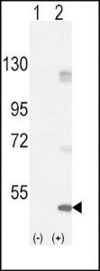 Anti-FGFR1 Rabbit Polyclonal Antibody