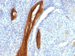 Anti-MUC1 Mouse Monoclonal Antibody [clone: 139H2]