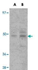 Anti-KDM8 Rabbit Polyclonal Antibody