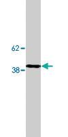 Anti-SAMD8 Polyclonal Antibody