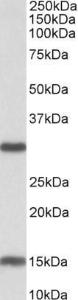 Anti-Sirt3 Antibody (A82776) (0.3 µg/ml) staining of Mouse Heart lysate (35 µg protein in RIPA buffer). Primary incubation was 1 hour. Detected by chemilu minescence