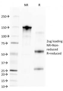 SDS-PAGE analysis of Anti-CD68 Antibody [C68/2709] under non-reduced and reduced conditions; showing intact IgG and intact heavy and light chains, respectively. SDS-PAGE analysis confirms the integrity and purity of the antibody