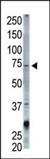 Anti-STAM Rabbit Polyclonal Antibody