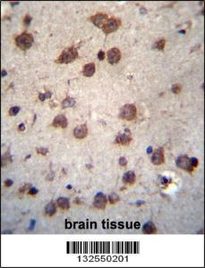 Anti-PHAX Rabbit Polyclonal Antibody (FITC (Fluorescein Isothiocyanate))