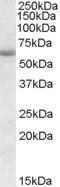 Anti-CDH23 antibody