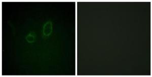 Immunofluorescence analysis of A549 cells using Anti-Moesin (phospho Thr558) Antibody. The right hand panel represents a negative control, where the antibody was pre-incubated with the immunising peptide