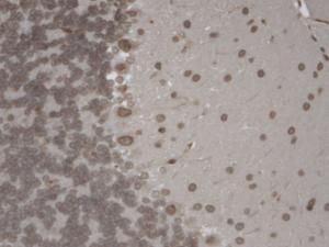 Anti-TRPM7 Mouse Monoclonal Antibody [clone: S74]