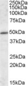 EB09292 (1 µg/ml) staining of Mouse Brain lysate (35 µg protein in RIPA buffer). Primary incubation was 1 hour. Detected by chemiluminescence.