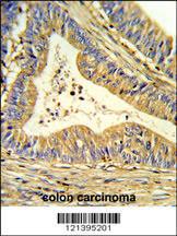 Anti-SOD1 Rabbit Polyclonal Antibody (Biotin)