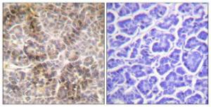 Immunohistochemical analysis of paraffin-embedded human pancreas using Anti-Moesin (phospho Thr558) Antibody. The right hand panel represents a negative control, where the antibody was pre-incubated with the immunising peptide