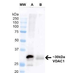 Western blot analysis of mouse brain and human room temperature-