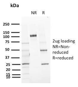 SDS-PAGE analysis of Anti-CD72 Antibody [BU40] under non-reduced and reduced conditions; showing intact IgG and intact heavy and light chains, respectively SDS-PAGE analysis confirms the integrity and purity of the antibody