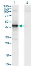 Anti-MAGEA11 Mouse Monoclonal Antibody [clone: 1C11]