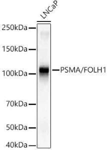 Western blot analysis of LNCaP, using Anti-PSMA Antibody [ARC56326] (A308936) at 1:20,000 dilution. The secondary antibody was Goat Anti-Rabbit IgG H&L Antibody (HRP) at 1:2000000 dilution.