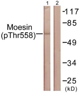 Western blot analysis of lysates from NIH/3T3 cells using Anti-Moesin (phospho Thr558) Antibody. The right hand lane represents a negative control, where the antibody is blocked by the immunising peptide