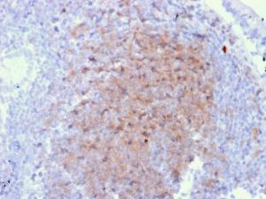 Immunohistochemical analysis of formalin-fixed, paraffin-embedded human lymph node in colon using Anti-CD72 Antibody [BU40]