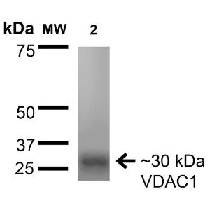 Western blot analysis of rat brain membrane showing detection of ~30 kDa VDAC1 protein using Anti-VDAC1 / Porin Antibody [S152B-23] (A304822) at 1:200 for 16 hours at 4°