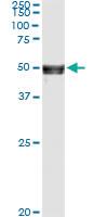 Anti-ANGPTL5 Antibody Pair