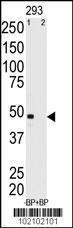 Anti-MAGEA11 Rabbit Polyclonal Antibody (FITC (Fluorescein))