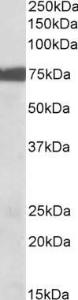 Anti-RPS6KA2 antibody