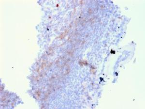 Immunohistochemical analysis of formalin-fixed, paraffin-embedded human lymph node in colon using Anti-CD72 Antibody [BU40]