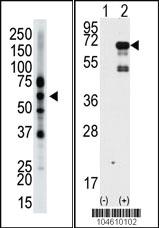 Anti-EPN2 Rabbit Polyclonal Antibody