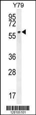 Anti-LCOR Rabbit Polyclonal Antibody (PE (Phycoerythrin))