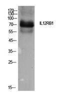 Western blot analysis of extracts from Hela cells using Anti-IL12RB1 Antibody