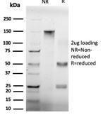 SDS-PAGE analysis of Anti-GTF2H2 Antibody [PCRP-GTF2H2-1B9] under non-reduced and reduced conditions; showing intact IgG and intact heavy and light chains, respectively. SDS-PAGE analysis confirms the integrity and purity of the antibody