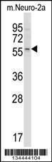 Anti-ACVR2B Rabbit Polyclonal Antibody (APC (Allophycocyanin))