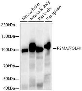 Western blot analysis of variou