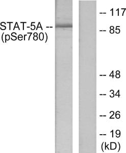 Western blot analysis of lysates from HeLa cells using Anti-STAT5A (phospho Ser780) Antibody. The right hand lane represents a negative control, where the antibody is blocked by the immunising peptide