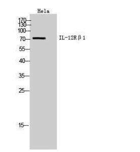 Western blot analysis of Hela cells using Anti-IL12RB1 Antibody