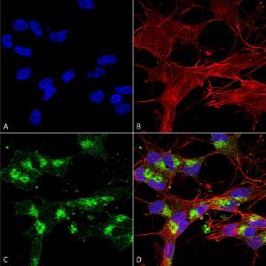 Immunocytochemistry/Immunofluorescence analysis of human neuroblastoma cells (SH-SY5Y), fixed in 4% PFA for 15 min, using Anti-VDAC1 / Porin Antibody [S152B-23] (A304822), at 1:100 for overnight at 4°C with slow rockin