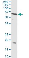 Anti-FXR2 Rabbit Polyclonal Antibody