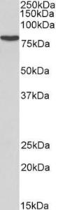 Anti-RPS6KA2 antibody