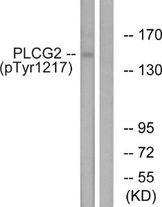 Western blot analysis of lysates from Jurkat cells treated with UV 15' using Anti-PLCG2 (phospho Tyr1217) Antibody. The right hand lane represents a negative control, where the antibody is blocked by the immunising peptide