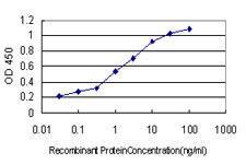 Anti-TSG101 Mouse Monoclonal Antibody [clone: 5B7]