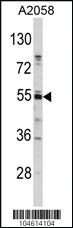 Anti-SQSTM1 (p62) Rabbit Polyclonal Antibody